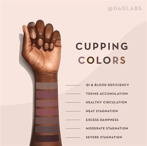 The Benefits of Cupping, According to Research in 2025 | Benefits of cupping, Cupping therapy ...