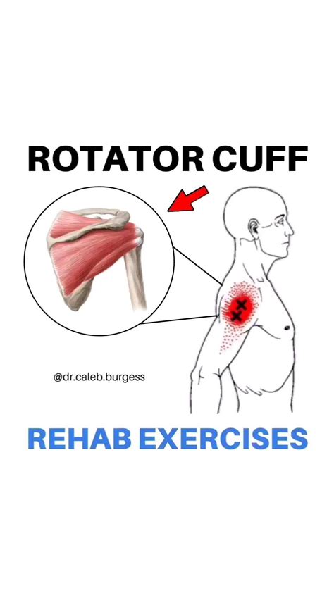 Rotator cuff pain relief build strength – Artofit