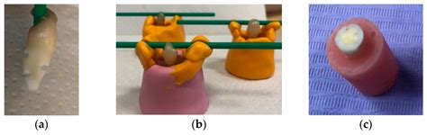 Effect of Temporary Cement, Surface Pretreatment and Tooth Area on the ...