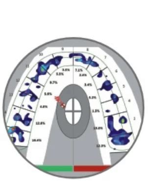 Tekscan Machine - T Scan digital occlusal system Trader - Wholesaler ...