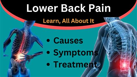 Lower Right or Left Back Pain (A-Z), Causes, Symptoms & Best