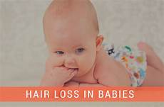 Infant Hair Loss by Hair Loss In Infants Day Care Quincy Ma A Child S View Infant Hair Loss