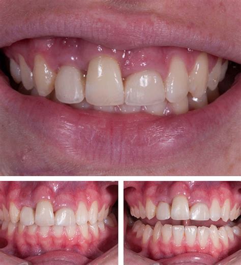 Image result for Ende Python