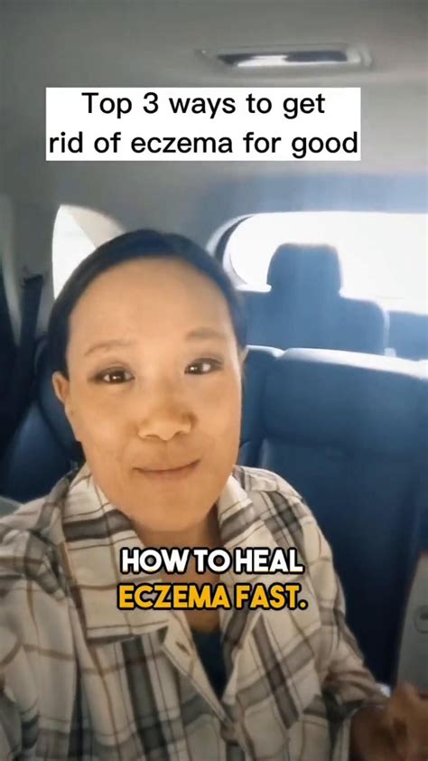 7 eczema remedies that work – Artofit