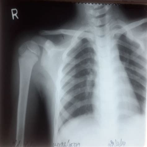 BONE, JOINT AND SPINE CARE - Non-Surgical Treatment
