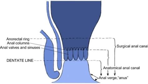 Image result for Exploded View Assembly