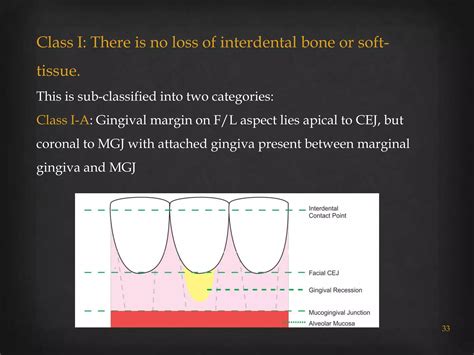 Gingival recession classifications | PPTX