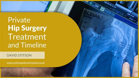 Private Hip Surgery Treatment And Timeline | David Stitson