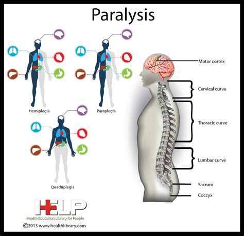 Different Forms Of Paralysis - Responsive Form Design