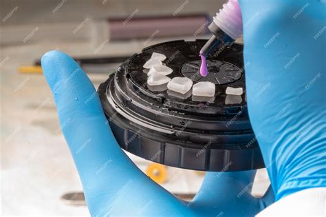 Premium Photo | Veneers cleaning for cementation dental procedure