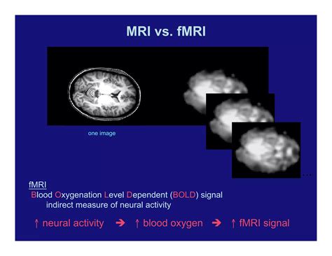 Cosmo-not: a brief look at methods of analysis in functional MRI and in ...
