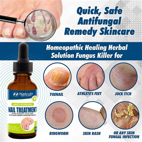 Extra Strength Natural Anti-Fungal Nail Treatment Drops - Homeopathic Herbal Fungus Killer for ...