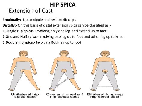Functional cast bracing and various pop spica cast | PPTX