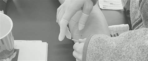 Dry Needling Courses for PTs, ATs, DCs, OTs, and CHTs