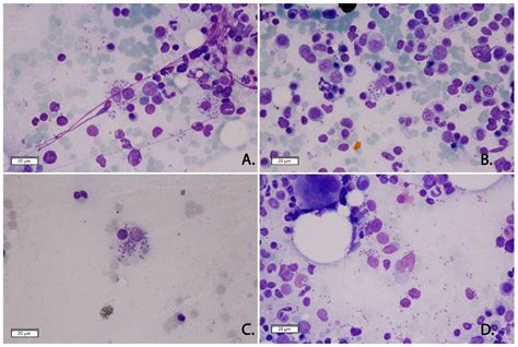 Imported Visceral Leishmaniasis in Timiș County, Western Romania