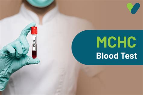 MCHC Blood Test: Meaning, Purpose & Normal Range