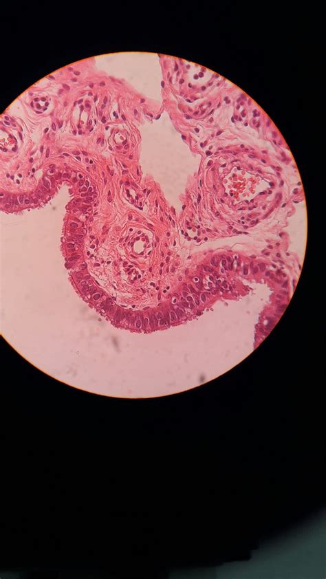 Trompa de Falopio, H&E. Epitelio cilíndrico simple y tejido conectivo ...