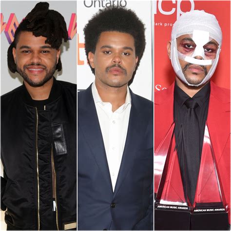 Did The Weeknd Get Plastic Surgery? Transformation Photos | Life & Style