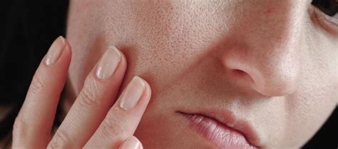 Find The Best Solution For Enlarged And Open Pores – Re'equil