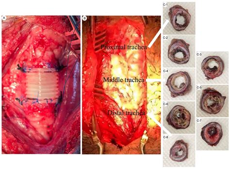 Bio-Printed PCL Tracheal Graft in a Large Animal Model: Reproducible ...