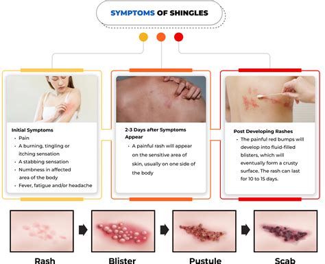 Beginning Stages Of Shingles