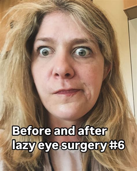Liz Brown | Before and after photos of my sixth and hopefully final ...
