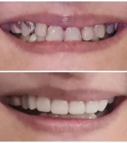 Orthosquare multispecialty dental chain best dentist in india