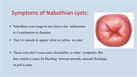 Benign lesions of cervix | PPTX