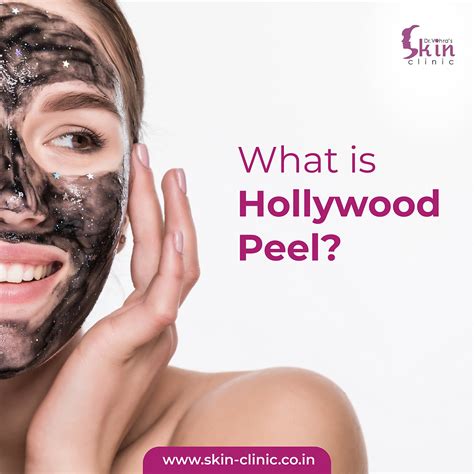 WHAT IS HOLLYWOOD PEEL?