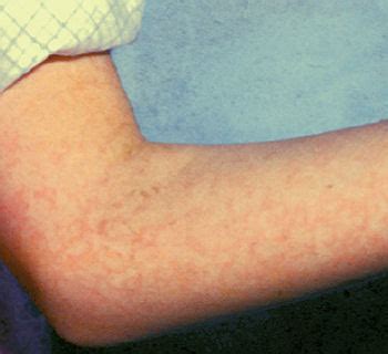 Bildergebnis für effloreszenz