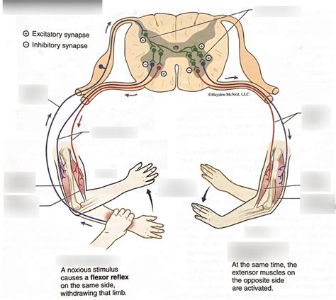 Image result for Crossed Extensor Reflex Demonstration