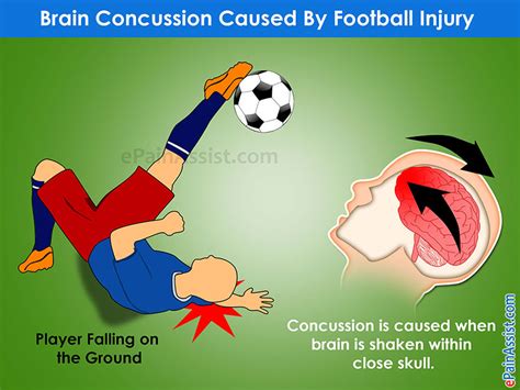 Common Football Injuries Are Sprain of Neck, Wrist, Ankle, Knee