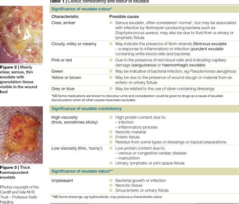 Wound Healing Yellow Discharge at Jonathan Landseer blog