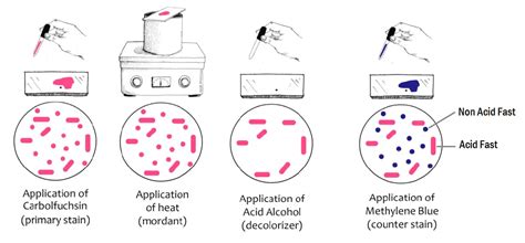 To perform acid fast staining