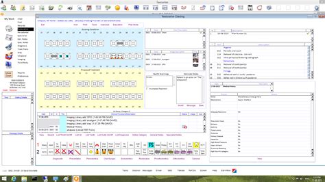 Image result for Oasis Charting Tutorial