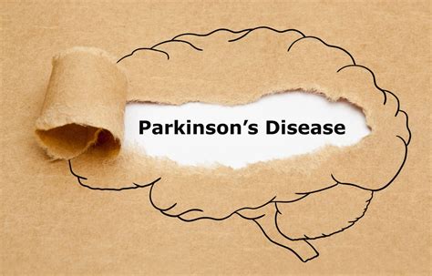 Hereditary hemochromatosis - a risk factor for incident Parkinson's disease