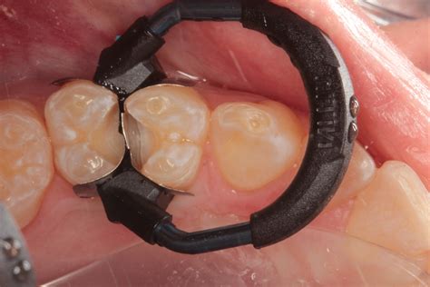 Image result for Sectional Matrix