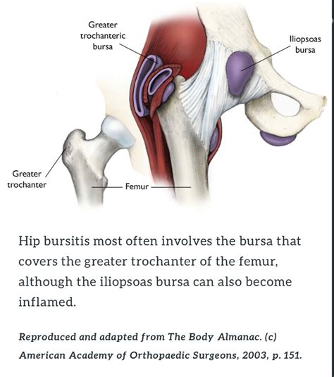 Bursitis of Hip and Gluteal Tendon Tears / Hip / Conditions and Treatment Options by Body Part ...