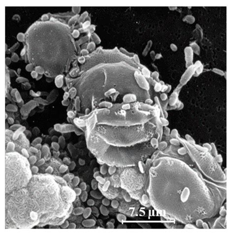 Microorganisms | Special Issue : Latest Review Papers in Environmental ...