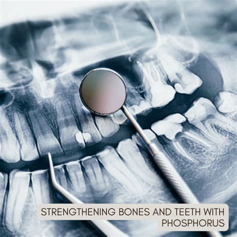 Phosphorus in Your Diet: Why It’s Essential for Your Health | Clinikally