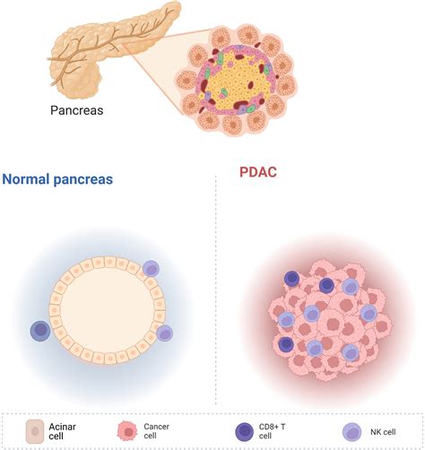 Cancer Antigen Pancreas at Andre Swain blog
