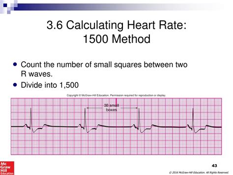 PPT - Electrocardiography for Healthcare Professionals PowerPoint ...