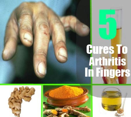 5 Natural Cures To Arthritis In Fingers - How To Cure Arthritis In ...