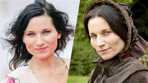Kate Fleetwood Face Surgery