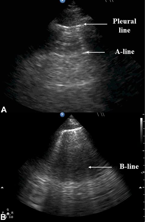 Holistic ultrasound in trauma: An update - Injury