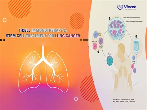 T-Cell Immunotherapy & Stem Cell Treatment For Lung Cancer - what cures lung cancer