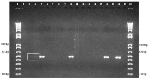 Beyond Domestic Cats: Environmental Detection of Sporothrix ...