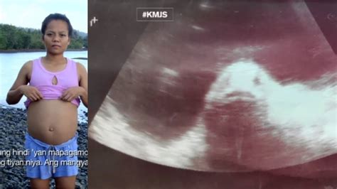 Bildergebnis für pregnant+with+fish