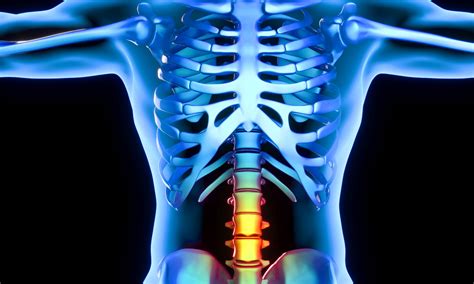 Hernia discal lumbar: ¿Cuándo es motivo suficiente para operarse?