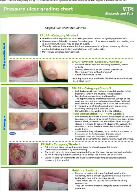 Skin Pressure Ulcer Stages , Overview: Pressure ulcers – BTMHZ